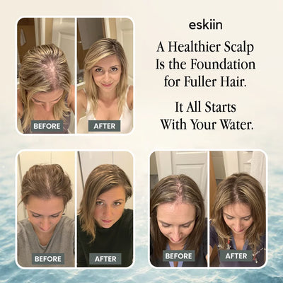 eskiin Filtered Showerhead