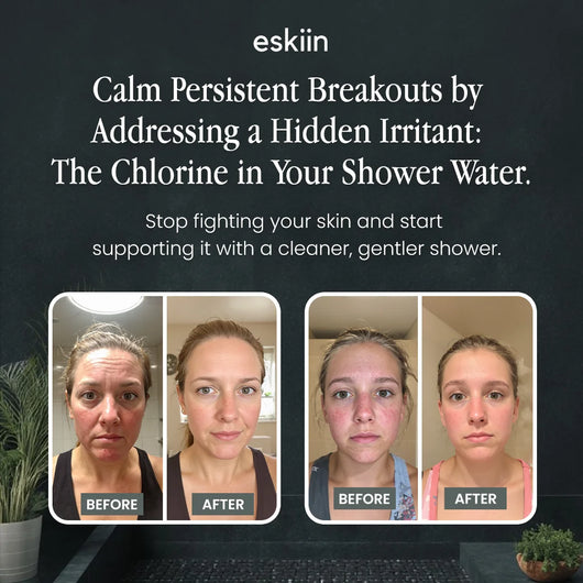 eskiin Filtered Showerhead